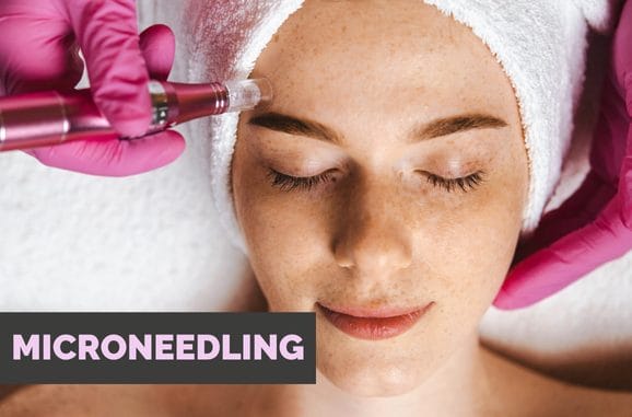 Ampoules de microneedling pour des problèmes spécifiques de la peau
